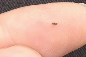 被跳蚤咬了怎么办？家中如何除灭跳蚤？图片