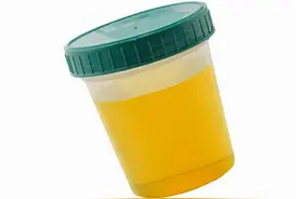 上厕所时尿液发黄，并伴有一股异味？建议注意下这5个方面图片