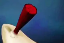 为什么骨科医生都不懂康复？一个膝盖竟然缝了109针！图片