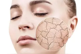 皮肤进入干燥危险期的信号，你占了几条？图片