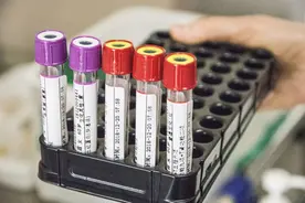 医生动不动就抽血，到底查些啥？抽出来的血，最终去哪儿了图片