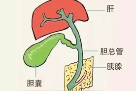 以前都是保胆取石，为啥如今查出胆结石，需要切除胆囊？令人思考图片
