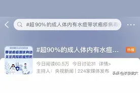 一旦感染，终身携带！疼痛可超分娩，90%的成人体内有这种病毒...网友：经历过才懂图片