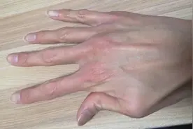 1米9的我常被当作山东大汉的代表，但我是得病了才又瘦又高的图片