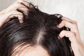 头皮老是长疙瘩和脓包，是怎么了？是癌症前兆吗？告诉你答案图片