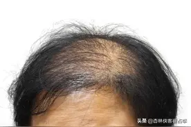 精血不足，人显老？两味中药，能补肾、养血、增强力气图片