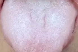 舌苔又白又厚，来源于这四个问题，中医教你从根源调理！图片