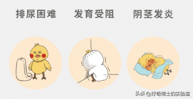 割不割包皮对男性究竟有啥影响？不割会怎么样？