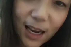 女子感染后长出浓密胡子图片