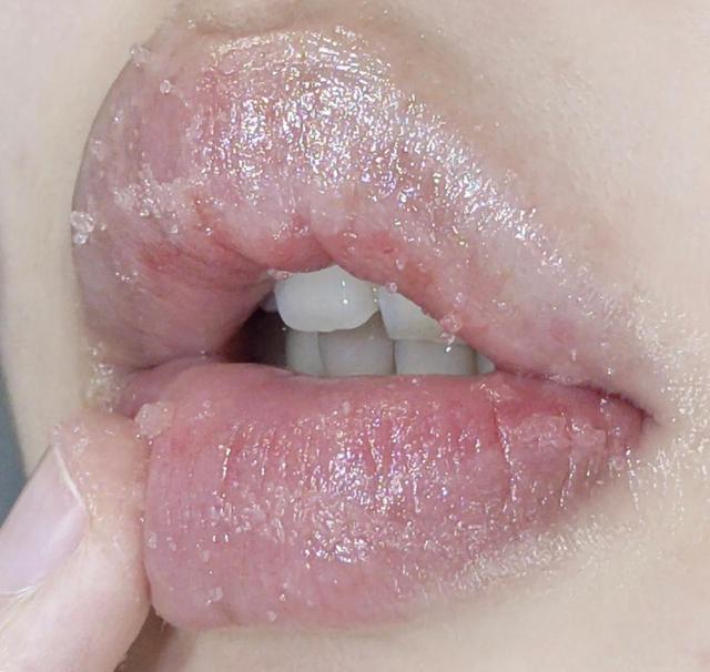 嘴唇颜色暗是什么原因怎么调理,「观面无隐私」唇色异常可能有难治