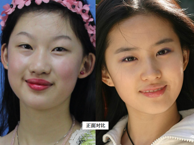 19岁少女非要整成"刘亦菲",连名字也高仿,6年后她现状怎样?