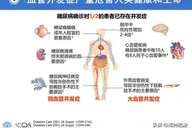 不能大意的糖尿病并发症图片