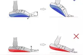 前脚掌有老茧伴有疼痛感怎么办？你所不了解的跖痛症图片