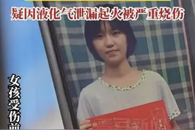 河北女孩做饭时因液化气泄漏被烧伤 水滴筹已筹集40万用于治疗图片