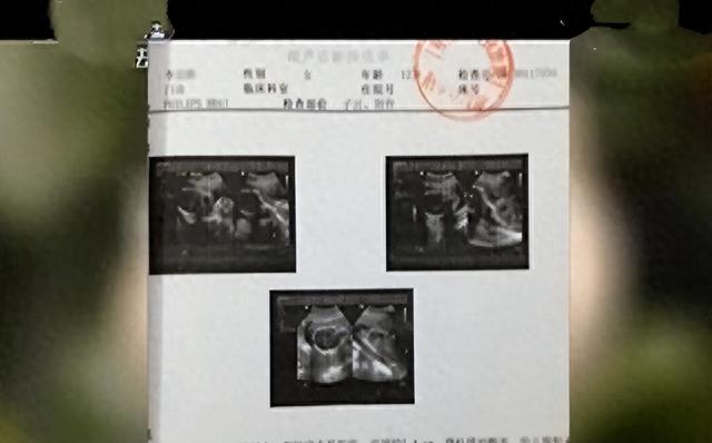 74岁男子强奸12岁少女，女子：你别这样太疼了！要是妈妈问怎么办