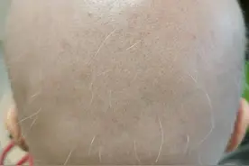 杭州90后姑娘崩溃：我头像一颗大卤蛋，怎么办……图片