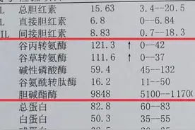 肝脏好不好？肝功能检测告诉你，三个指标很重要图片