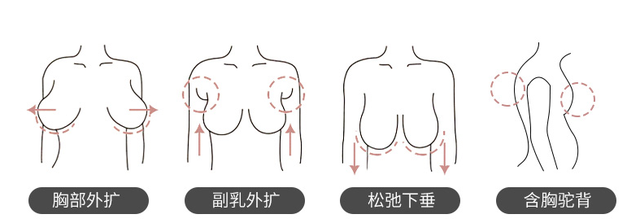 调整型内衣和普通型内衣有什么区别？你穿对了吗