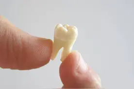 梦见掉牙要注意了，可能影响到您的财运图片