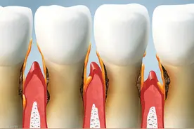 如何科学地保护牙齿？图片