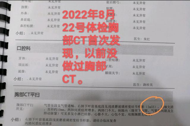 ct检查中肺部im是什么单位（刘懿博士说肺癌五六六三从im33到im37）