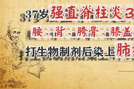 37岁强直脊柱炎3年，腰痛背痛胯骨痛，打生物制剂后染上肺结核图片