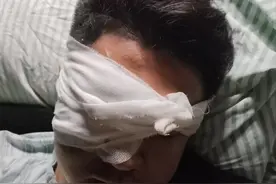 寻目击证人！男子被烟花击中，眼球摘除，当事人全网求白帽女现身图片