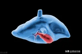 早期肝癌的五年生存率高达90%！肝癌不同风险人群应重视筛查、早筛早治图片