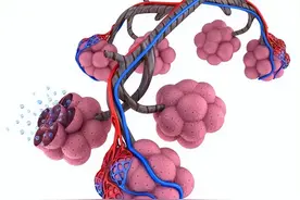肺大疱与肺大泡的区别，会破裂引起气胸吗？怎么治疗？图片