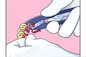 男性结扎和女性结扎，哪个伤害更大？男性结扎会降低性能力吗？图片