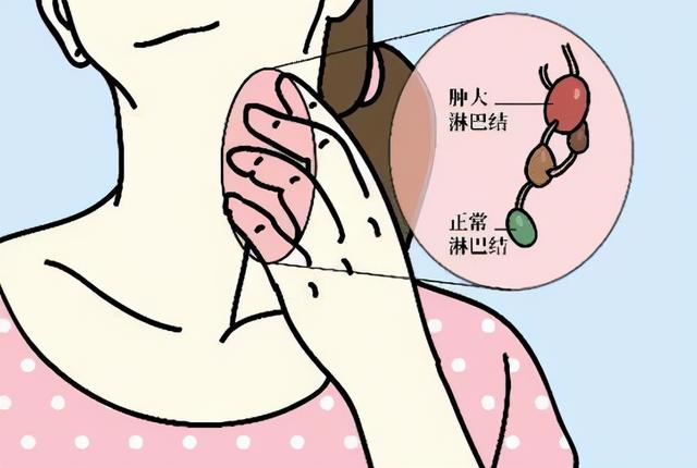 粘清婉