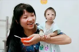 2009年湖南夫妇生下"小猴子"，差点被杂技团买走，如今孩子咋样了图片