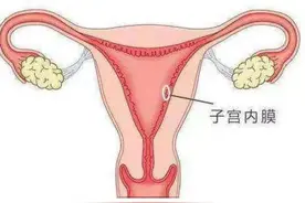 40岁后得注意子宫内膜厚度及异常出血啦！图片