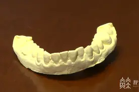 记者观察：网购自制牙齿矫正器操作有难度 矫治效果存在明显差异图片