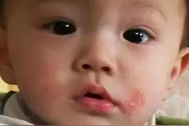 床上“螨虫成堆”？老保姆教你个“土法子”，五分钟，螨虫全消失图片