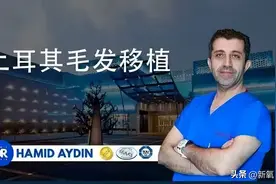 全球植发之都：一个适合种头发做发际线的国家图片