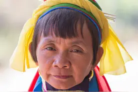 10个拥有罕见身体特征的人类：骨头比普通人硬8倍，卡车都撞不断图片