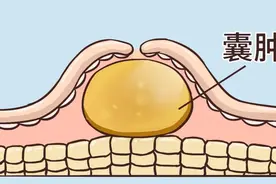 结节、囊肿、息肉？一剂小金丹，一路破结，一路化痰，一路通络图片