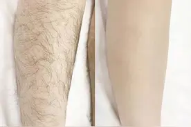 为什么有的女性体毛旺盛，有的却“光秃秃”？看完涨知识了图片