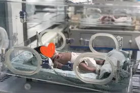 家有早产儿，一定要知道的六点，护理尤为重要图片