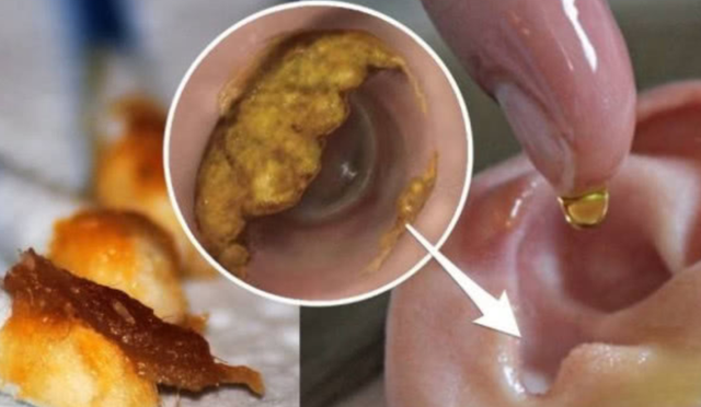 医生提醒:耳朵里面经常痒,可能是这4种病的表现,最好上点心!