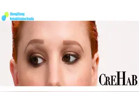 每天10min，提升上眼睑，拯救“高低|大小眼”图片