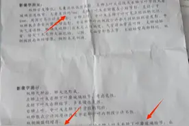 与前片对比，左肺上叶、右肺下叶5mm磨玻璃结节消失！图片