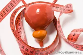 前列腺有病，小便先知，注意5种异常表现，或是前列腺肥大的信号图片