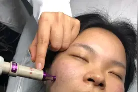 疤痕增生凸起了怎么办？疤痕增生凸起一块肉怎么治疗？图片