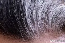 中医奇才倪海厦的养发秘籍：脱发治肝，白发治肾，还你一头秀发图片