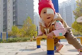 哈尔滨女子二胎生下女儿，家人欢笑9个月后，才发现她是“猫眼”图片