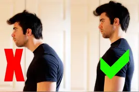 头前倾的危害，你知道吗？头前倾如何矫正？图片