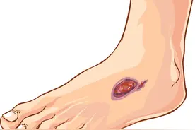 不是脚部衰老，而是疾病信号？脚部出现6种异样，或是身体的警报图片