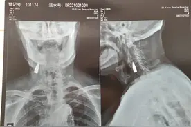 临沂95岁抗战老兵就医发现颈部有子弹，女婿：目前老人身体状况良好，不取出来了图片